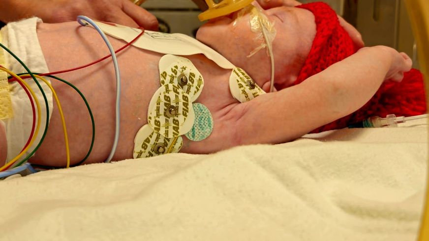 Lidl România împreună cu Asociația Cristi Vasiliu (ACV România) dotează Spitalul Clinic de Urgență pentru copii „Marie S. Curie” din București cu primul RMN Neonatal din România